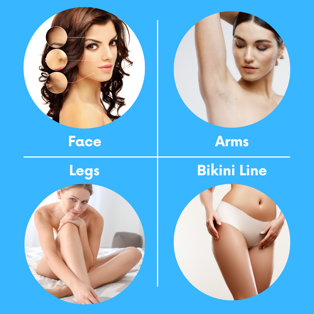 Hair removal zones for face, arms, legs, and bikini line